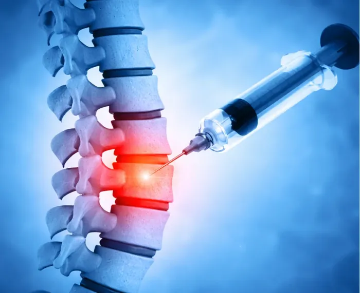 Intervencionismo de columna vertebral